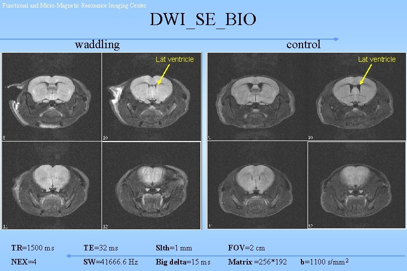 Functional and Micro-Magnetic Resonance Imaging Center DWI_SE_BIO waddling control Lat ventricle TR=1500 ms TE=32