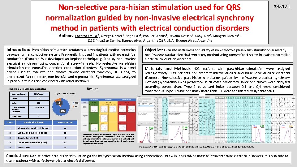 Non-selective para-hisian stimulation used for QRS normalization guided by non-invasive electrical synchrony method in