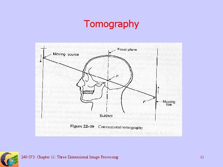 Tomography 240 -373: Chapter 11: Three Dimensional Image Processing 11 