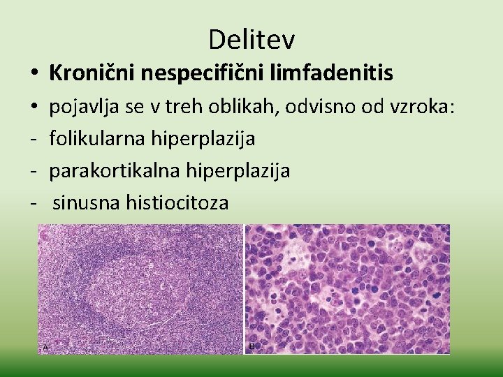 Delitev • Kronični nespecifični limfadenitis • pojavlja se v treh oblikah, odvisno od vzroka: