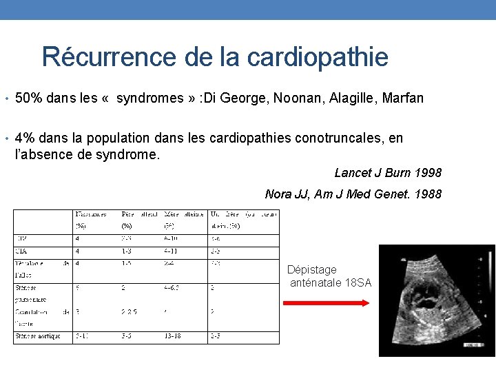 Récurrence de la cardiopathie • 50% dans les « syndromes » : Di George,