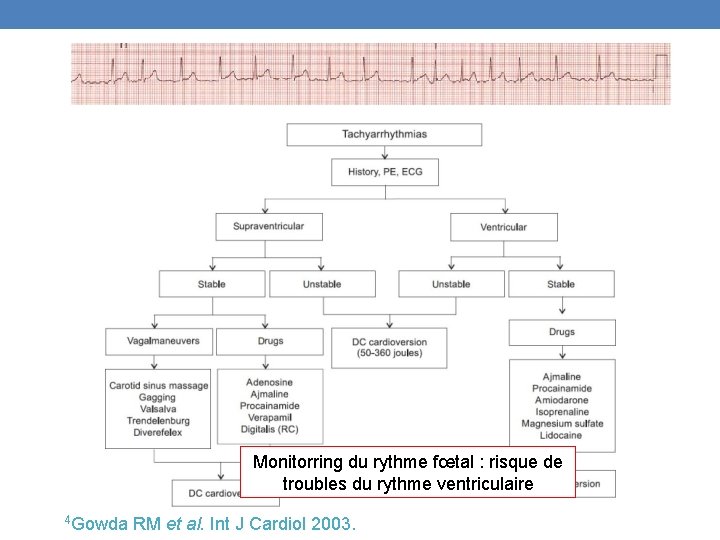 Monitorring du rythme fœtal : risque de troubles du rythme ventriculaire 4 Gowda RM