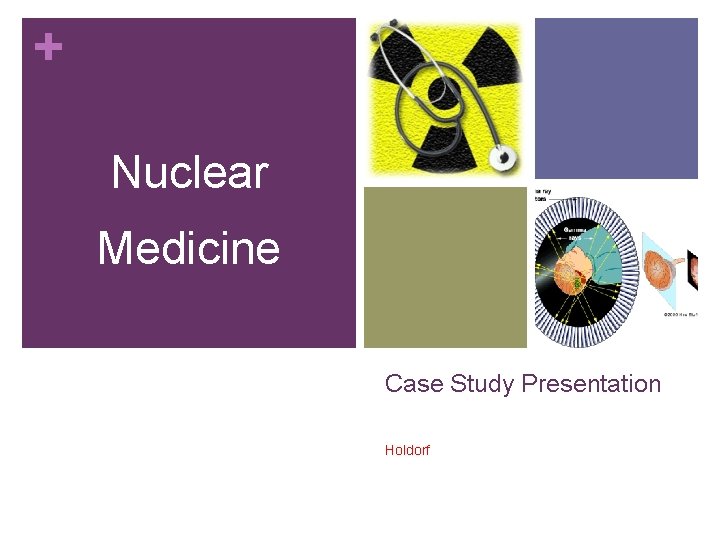 + Nuclear Medicine Case Study Presentation Holdorf 