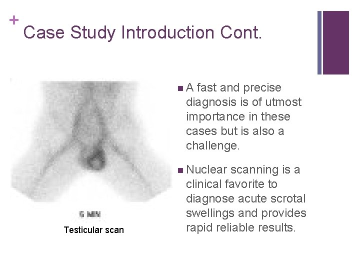 + Case Study Introduction Cont. n A fast and precise diagnosis is of utmost