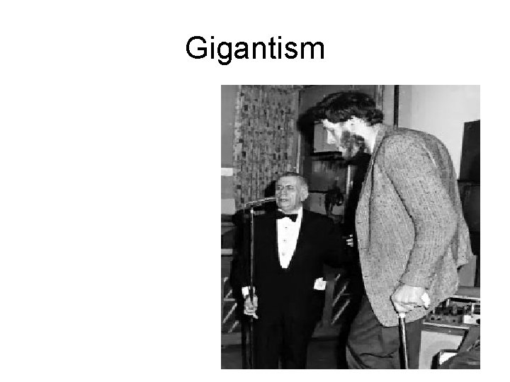 Gigantism 