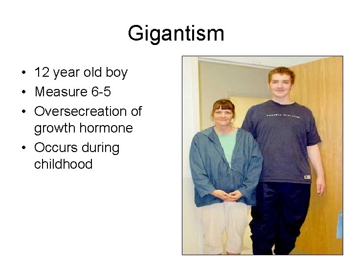 Gigantism • 12 year old boy • Measure 6 -5 • Oversecreation of growth