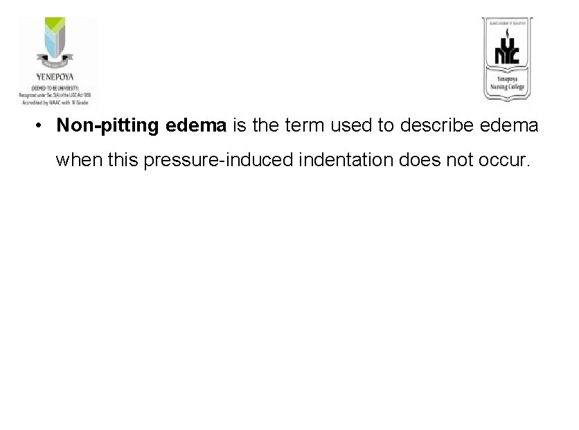  • Non-pitting edema is the term used to describe edema when this pressure-induced