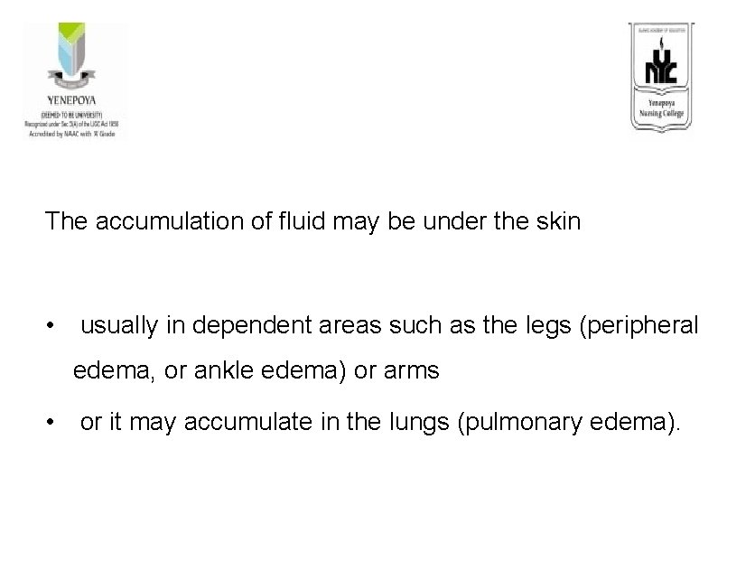 The accumulation of fluid may be under the skin • usually in dependent areas
