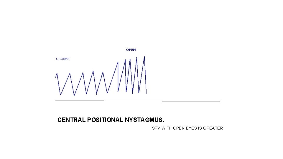 CENTRAL POSITIONAL NYSTAGMUS. SPV WITH OPEN EYES IS GREATER 