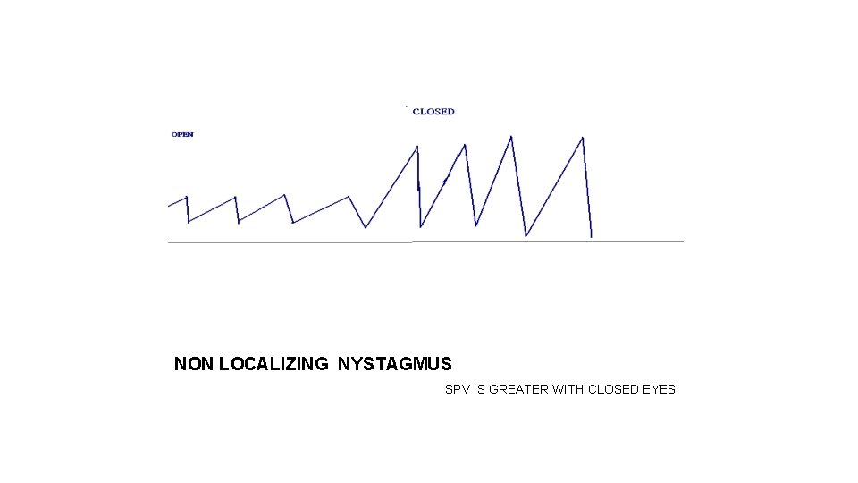 NON LOCALIZING NYSTAGMUS SPV IS GREATER WITH CLOSED EYES 