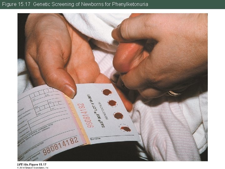 Figure 15. 17 Genetic Screening of Newborns for Phenylketonuria 