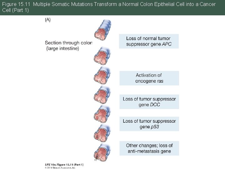 Figure 15. 11 Multiple Somatic Mutations Transform a Normal Colon Epithelial Cell into a