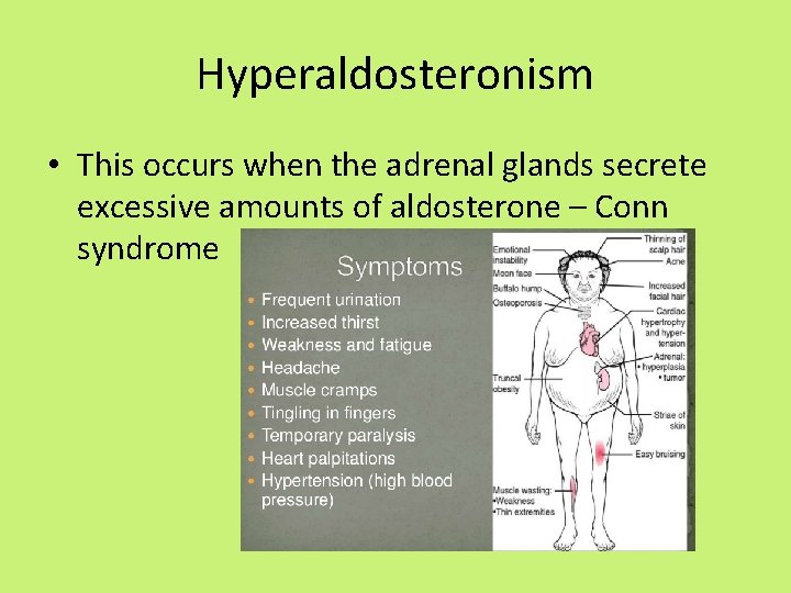 Hyperaldosteronism • This occurs when the adrenal glands secrete excessive amounts of aldosterone –