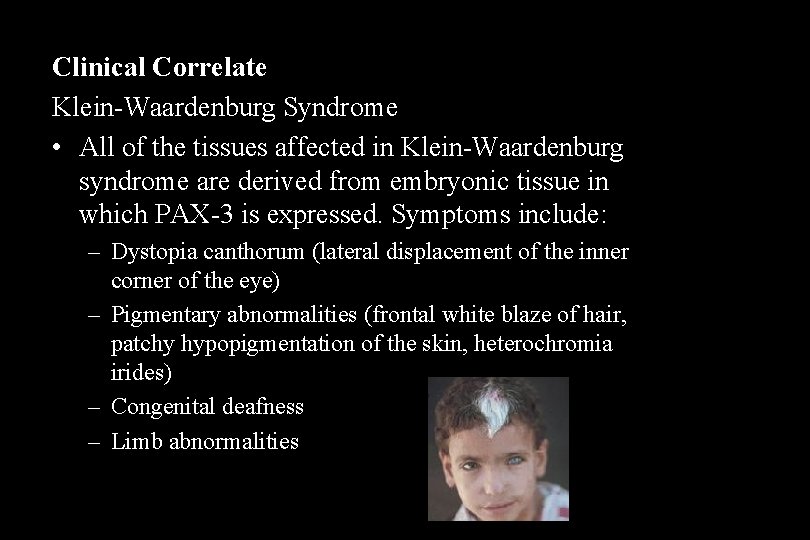 Clinical Correlate Klein-Waardenburg Syndrome • All of the tissues affected in Klein-Waardenburg syndrome are