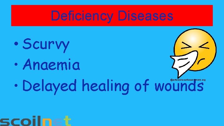 Deficiency Diseases • Scurvy • Anaemia • Delayed healing of wounds @antares/creativecommons. org 