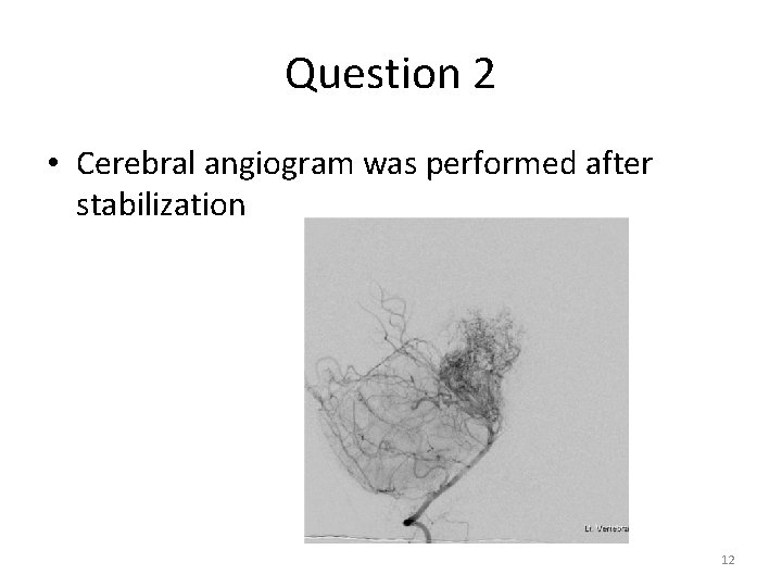 Question 2 • Cerebral angiogram was performed after stabilization 12 Question 2 • Cerebral angiogram was performed after stabilization 12