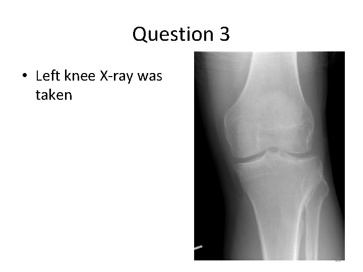 Question 3 • Left knee X-ray was taken 15 Question 3 • Left knee X-ray was taken 15