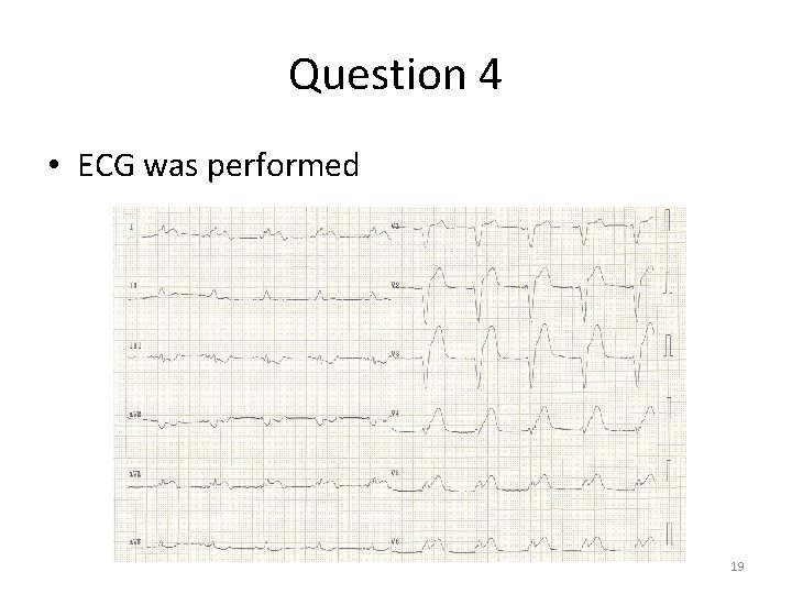 Question 4 • ECG was performed 19 Question 4 • ECG was performed 19