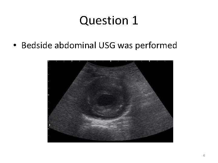 Question 1 • Bedside abdominal USG was performed 4 Question 1 • Bedside abdominal USG was performed 4