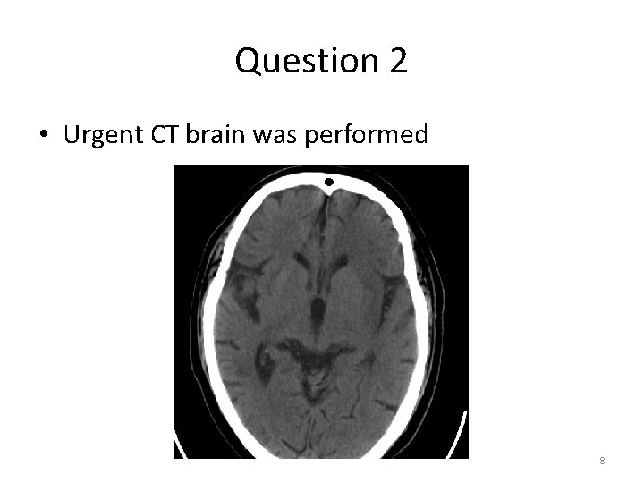 Question 2 • Urgent CT brain was performed 8 Question 2 • Urgent CT brain was performed 8