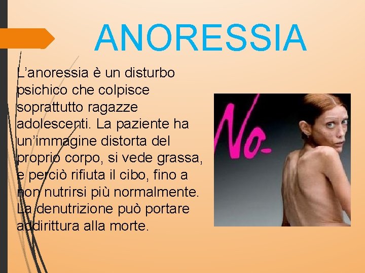 ANORESSIA L’anoressia è un disturbo psichico che colpisce soprattutto ragazze adolescenti. La paziente ha