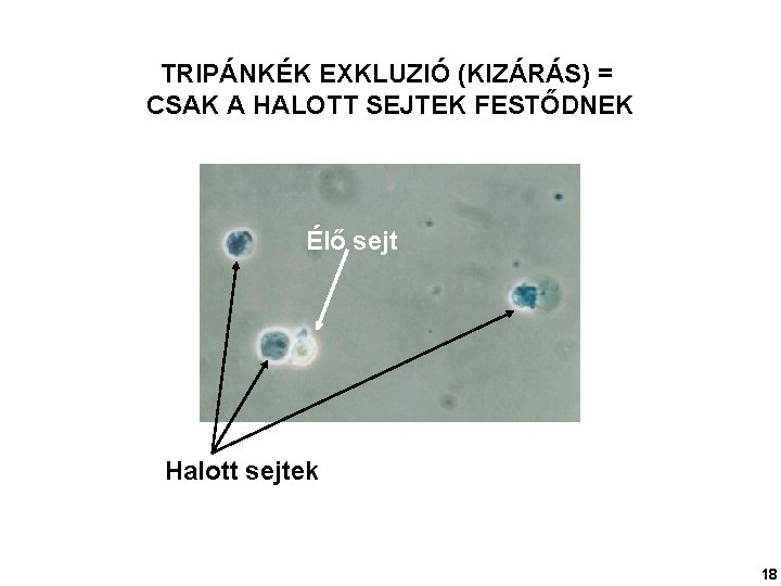 TRIPÁNKÉK EXKLUZIÓ (KIZÁRÁS) = CSAK A HALOTT SEJTEK FESTŐDNEK Élő sejt Halott sejtek H