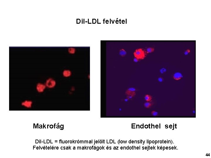 Dil-LDL felvétel Makrofág Endothel sejt Di. I-LDL = fluorokrómmal jelölt LDL (low density lipoprotein).