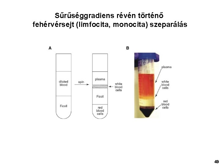 Sűrűséggradiens révén történő fehérvérsejt (limfocita, monocita) szeparálás 49 