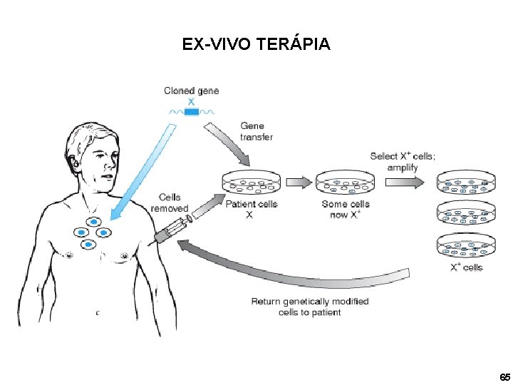 EX-VIVO TERÁPIA 65 