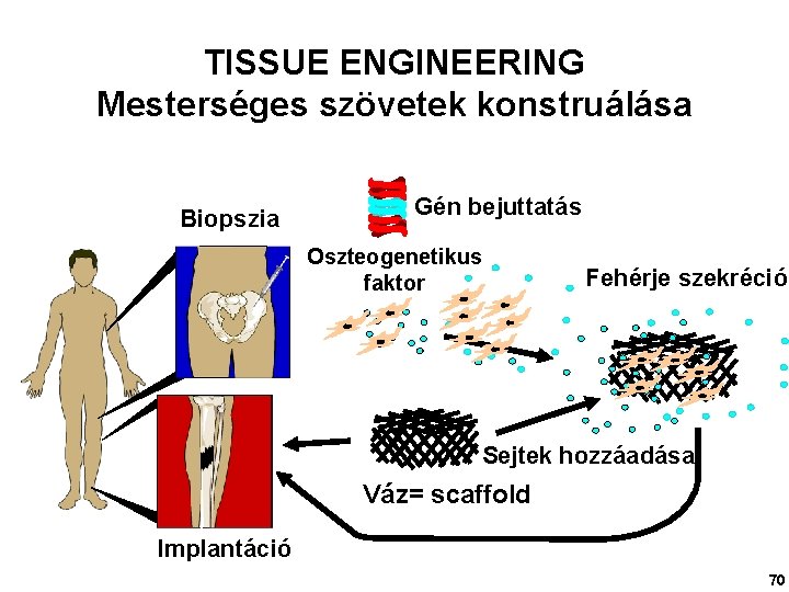 TISSUE ENGINEERING Mesterséges szövetek konstruálása Biopszia Gén bejuttatás Oszteogenetikus faktor Fehérje szekréció Sejtek hozzáadása
