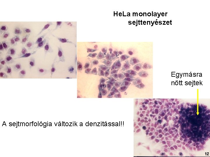 He. La monolayer sejttenyészet Egymásra nőtt sejtek A sejtmorfológia változik a denzitással!! 12 