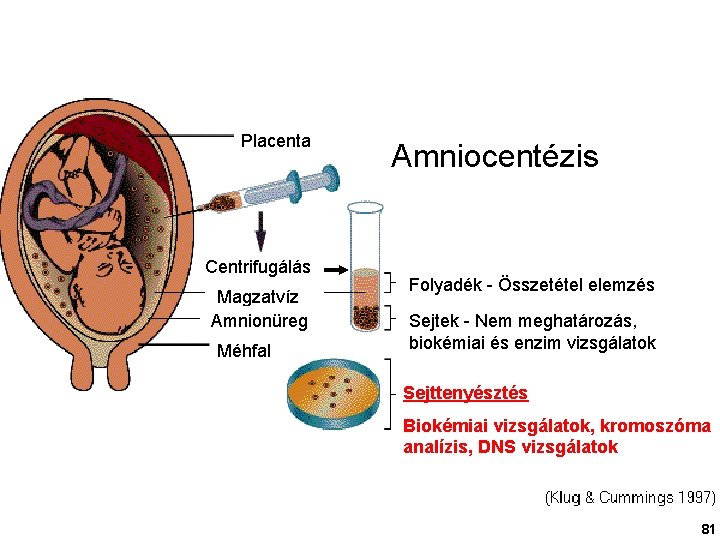 Placenta Centrifugálás Magzatvíz Amnionüreg Méhfal Amniocentézis Folyadék - Összetétel elemzés Sejtek - Nem meghatározás,