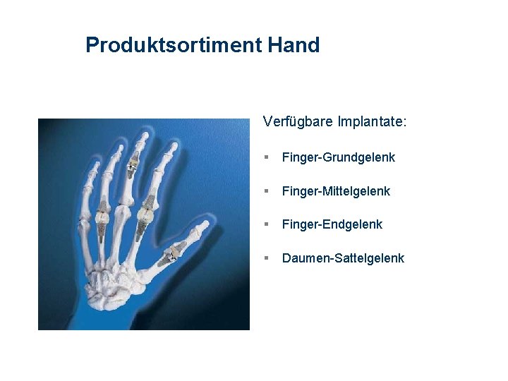 Produktsortiment Hand Verfügbare Implantate: § Finger-Grundgelenk § Finger-Mittelgelenk § Finger-Endgelenk § Daumen-Sattelgelenk 