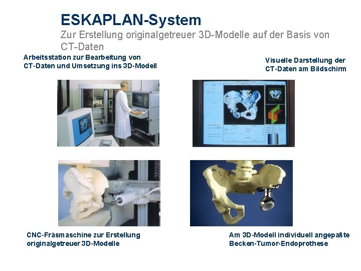 ESKAPLAN-System Zur Erstellung originalgetreuer 3 D-Modelle auf der Basis von CT-Daten Arbeitsstation zur Bearbeitung