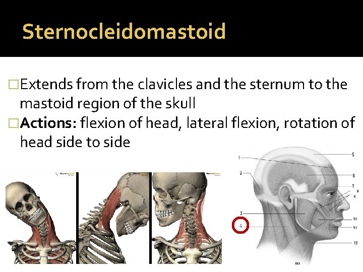 Sternocleidomastoid �Extends from the clavicles and the sternum to the mastoid region of the