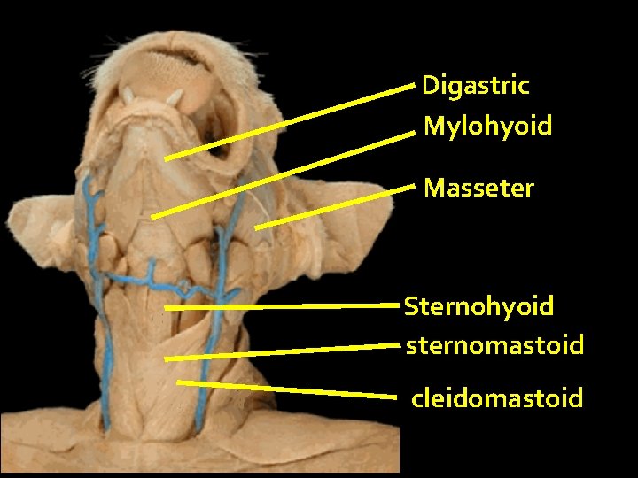 Digastric Mylohyoid Masseter Sternohyoid sternomastoid cleidomastoid 