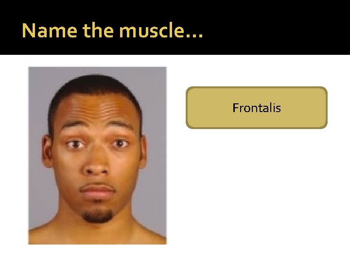 Name the muscle… Frontalis 