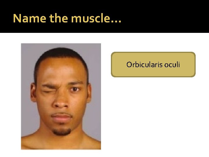 Name the muscle… Orbicularis oculi 