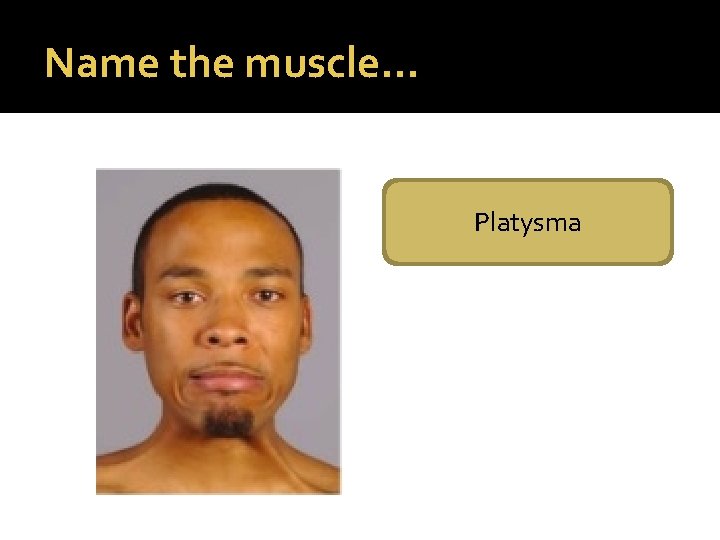 Name the muscle… Platysma 