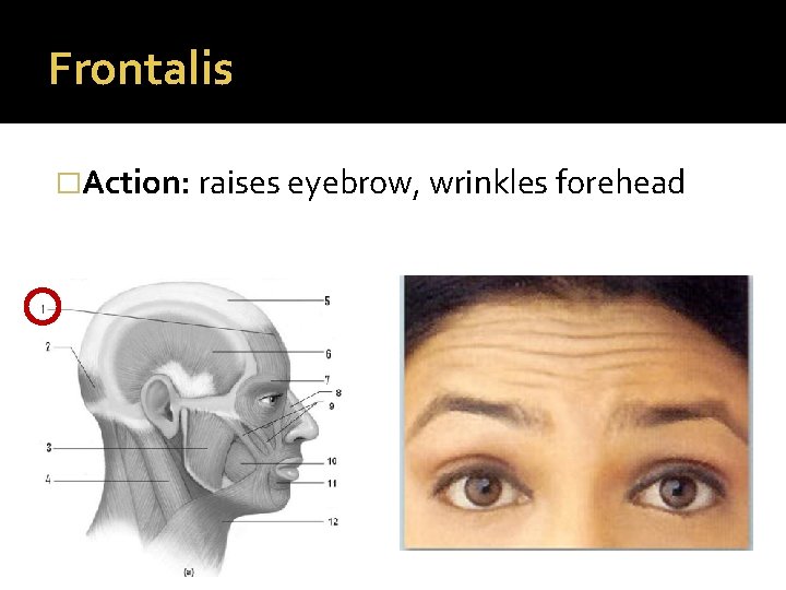 Frontalis �Action: raises eyebrow, wrinkles forehead 