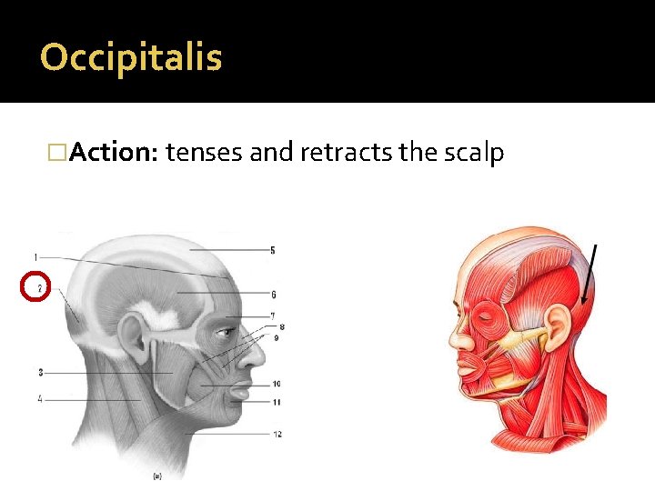 Occipitalis �Action: tenses and retracts the scalp 