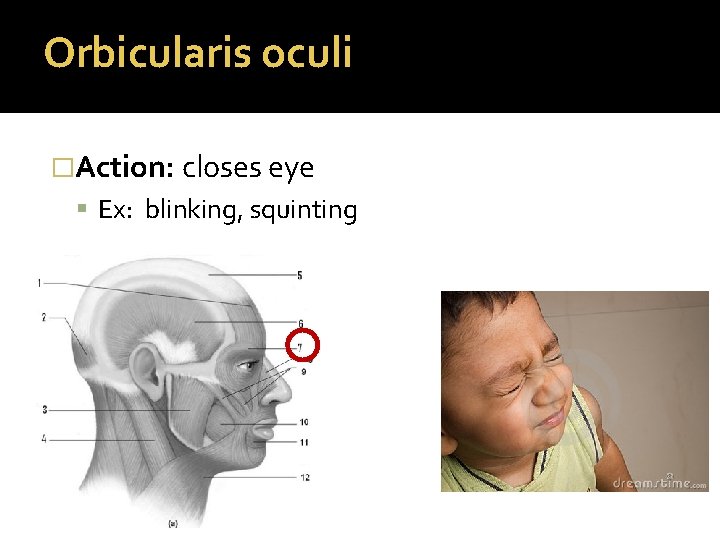 Orbicularis oculi �Action: closes eye Ex: blinking, squinting 