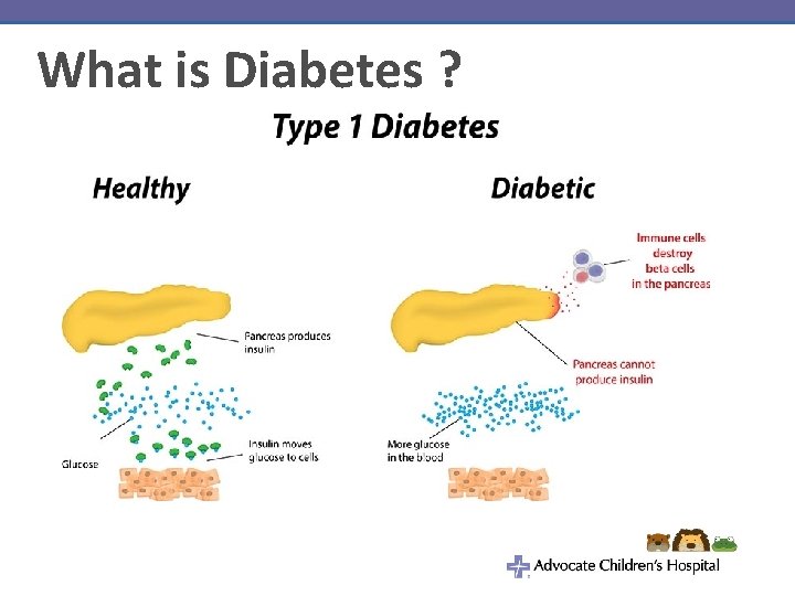 What is Diabetes ? 