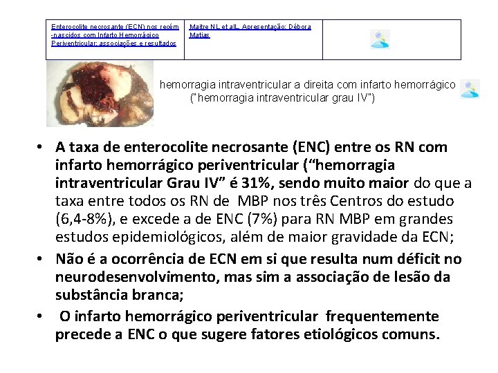 Enterocolite necrosante (ECN) nos recém -nascidos com Infarto Hemorrágico Periventricular: associações e resultados Maitre