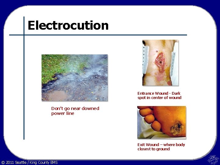 Electrocution Entrance Wound - Dark spot in center of wound Don’t go near downed