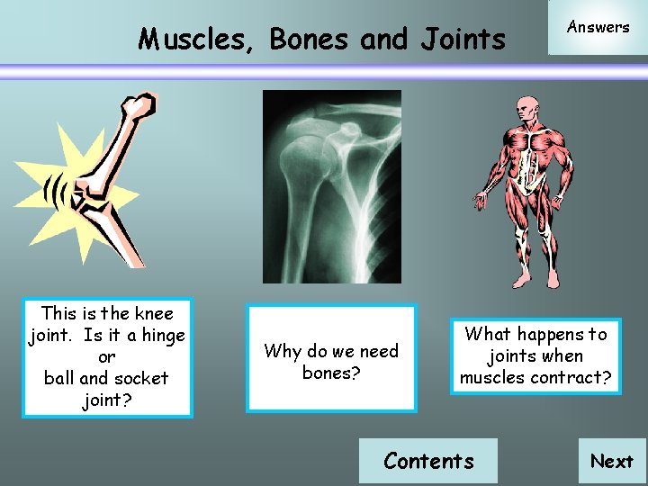 Muscles, Bones and Joints This is the knee joint. Is it a hinge or