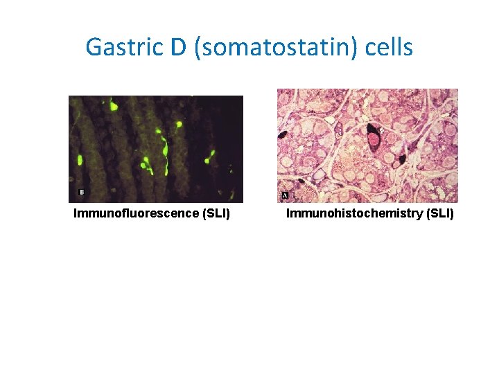 Gastric D (somatostatin) cells Immunofluorescence (SLI) Immunohistochemistry (SLI) 