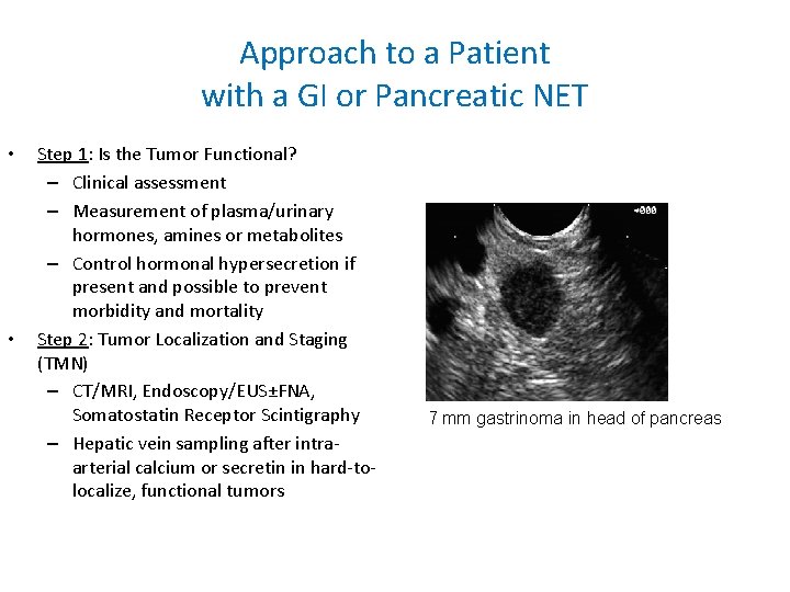 Approach to a Patient with a GI or Pancreatic NET • • Step 1: