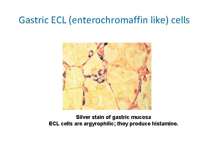 Gastric ECL (enterochromaffin like) cells Silver stain of gastric mucosa ECL cells are argyrophilic;