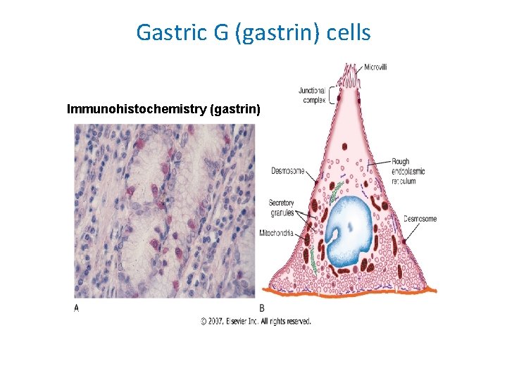 Gastric G (gastrin) cells Immunohistochemistry (gastrin) 